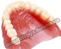 протезирование зубов донецк акриловый зубной протез