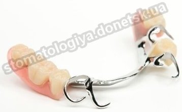 протезирование зубов донецк бюгельный зубной протез